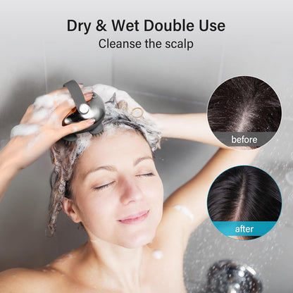Arboleaf Rechargeable Scalp Massager for Stress Relief
